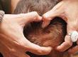 Scalp Pain: What Causes It?