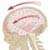 How to Recognise a Concussion Headache