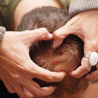 Scalp Pain Headache Tenderness Skull